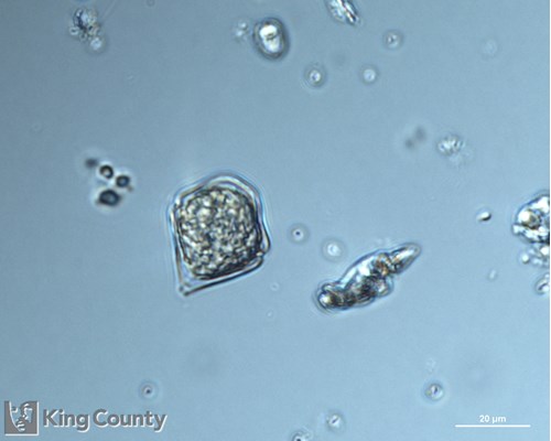 Photo of Scrippsiella trochoidea
